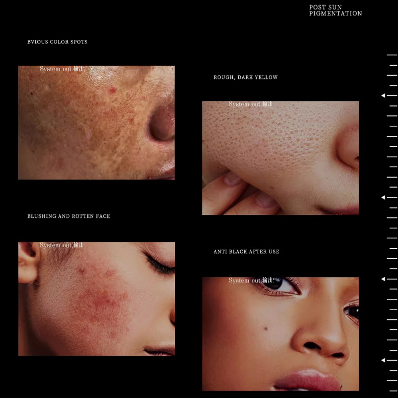 1.94온스 천연 럭셔리 나이아신아마이드 브라이트닝 페 - Luxury Skincare Anti Aging 리뷰 및 가격